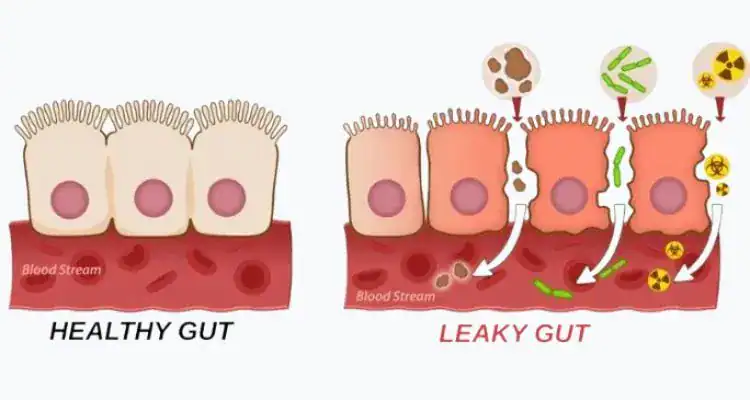 Gut health symptoms illustration